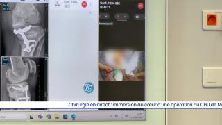 Chirurgie en direct : immersion au cœur d’une opération au CHU de Martinique